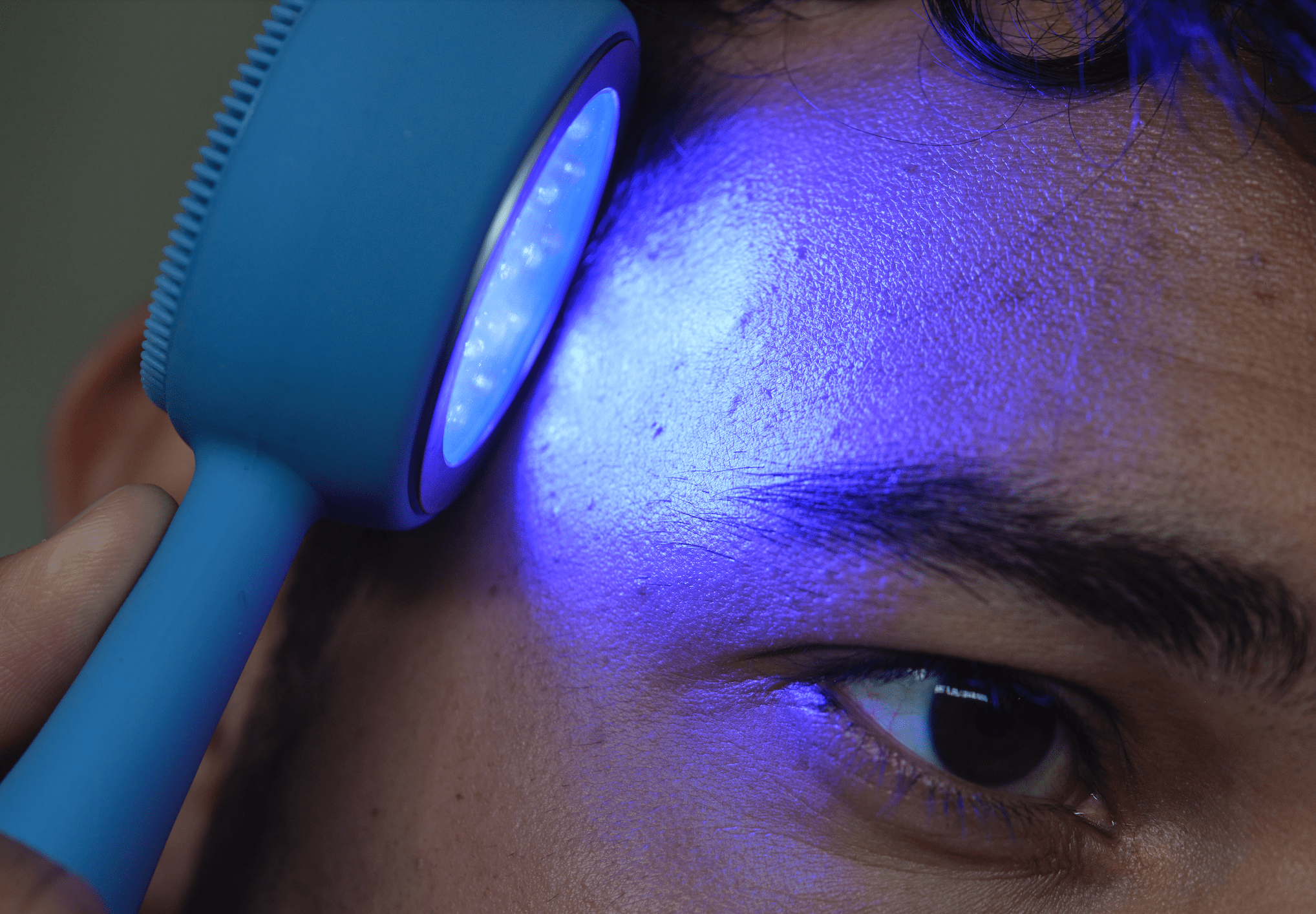 The Best Skincare Routine for Post-Acne Marks