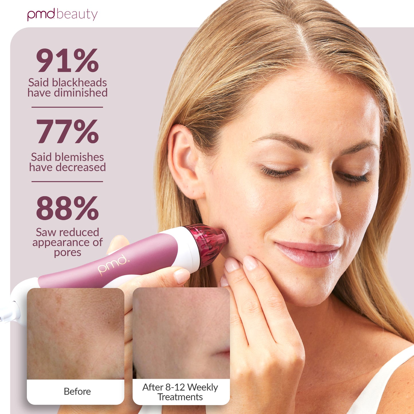 Personal Microderm Classic