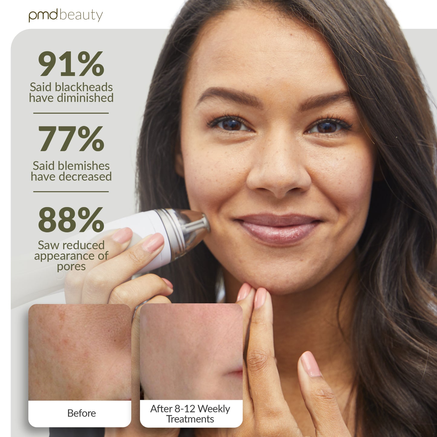 Personal Microderm Pro