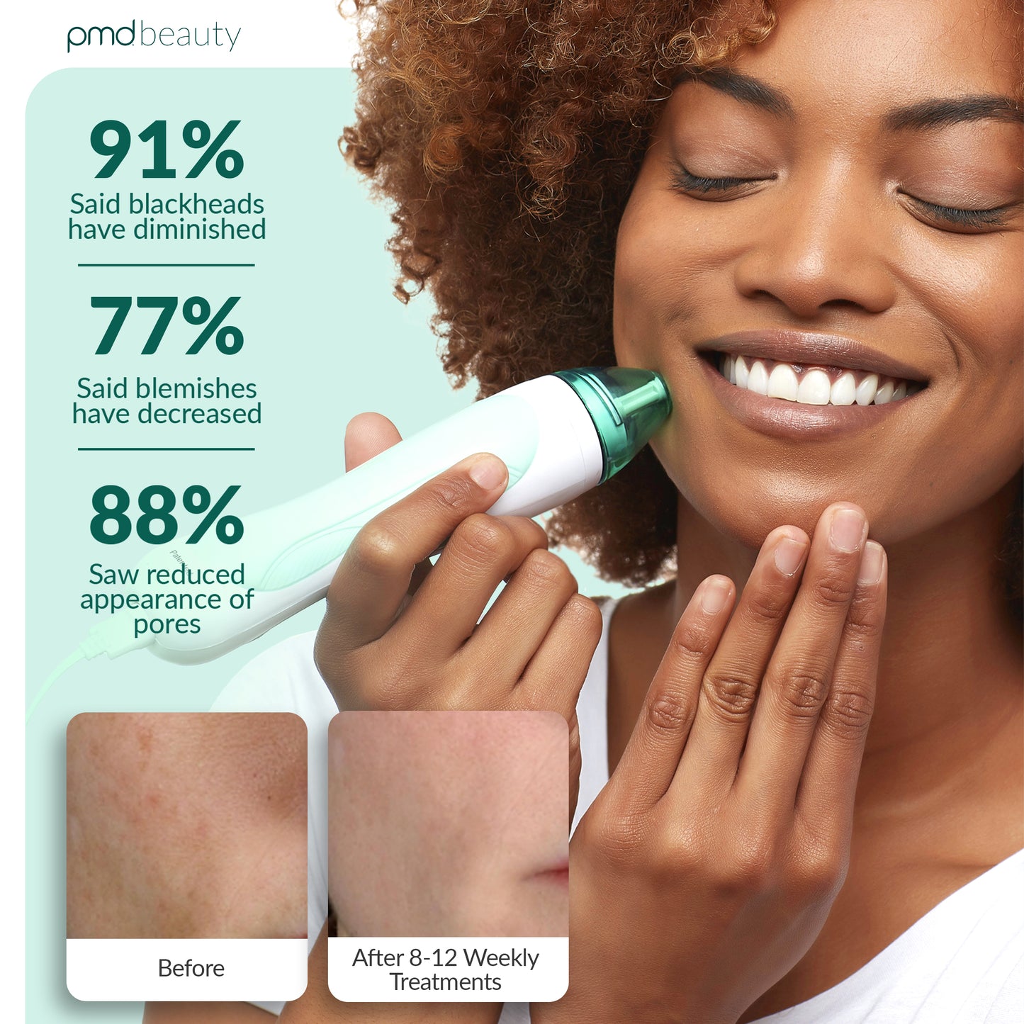 Personal Microderm Pro