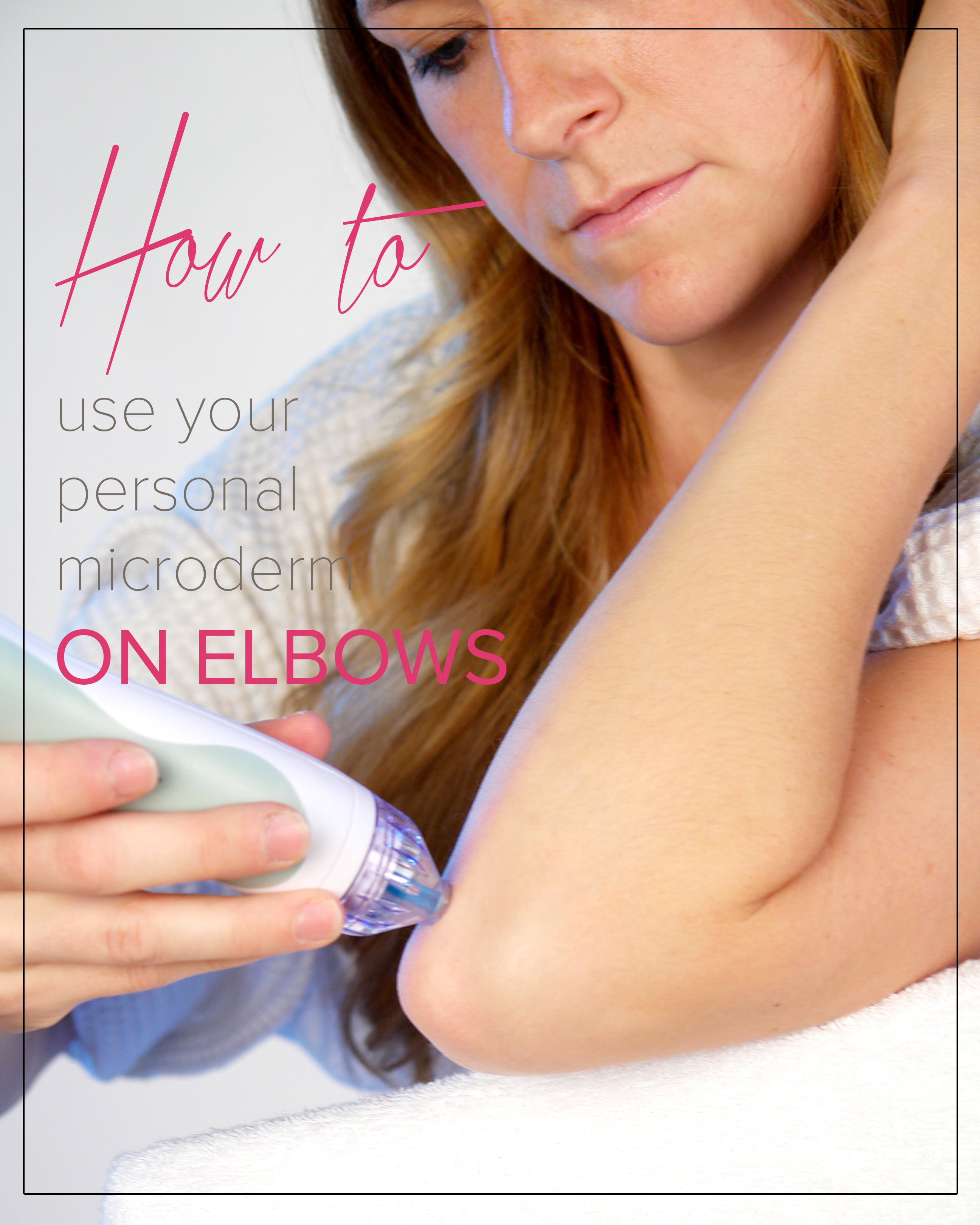 How to Use Your Personal Micorderm on Elbows