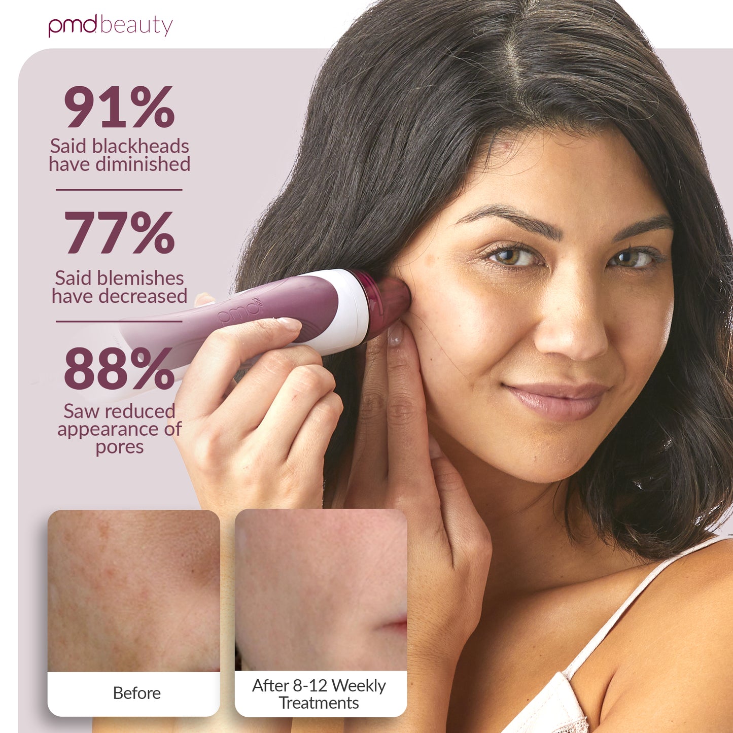 Personal Microderm Pro