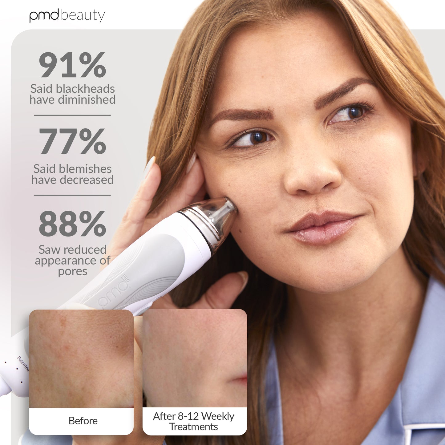 Personal Microderm Pro