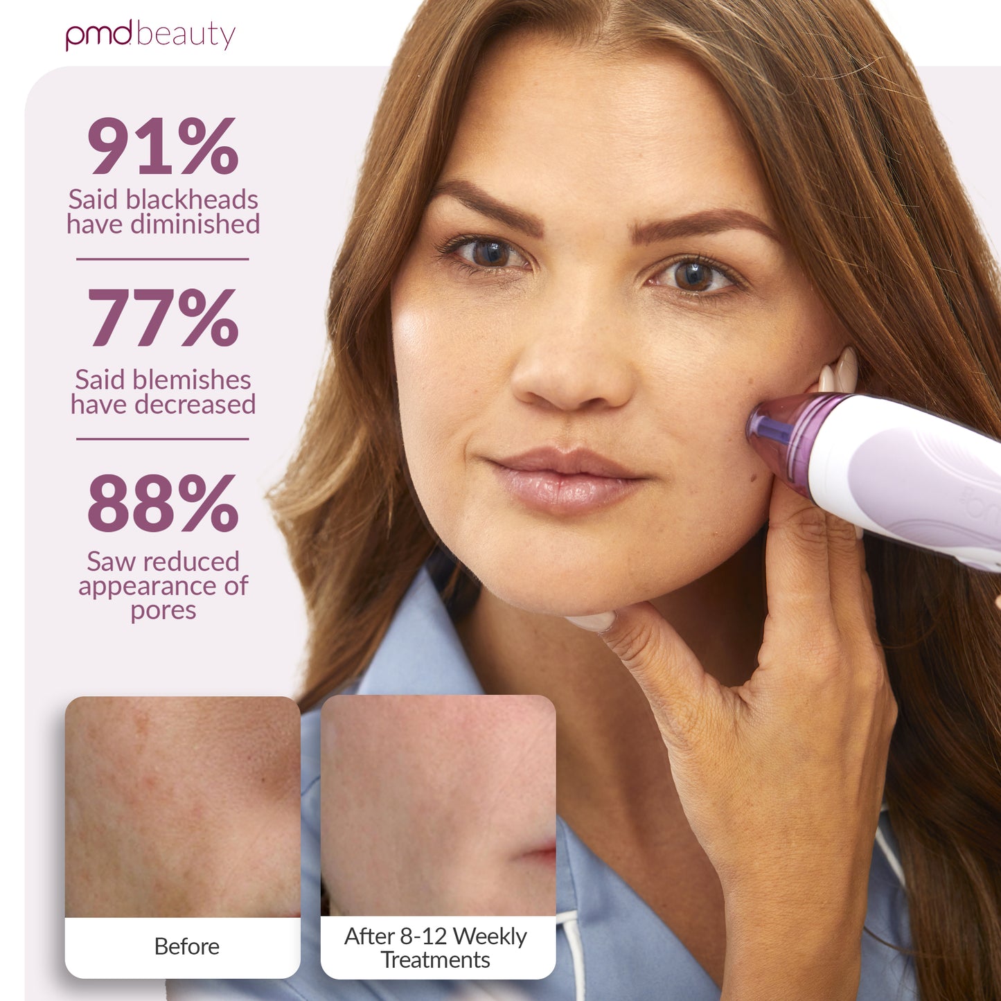 Personal Microderm Pro