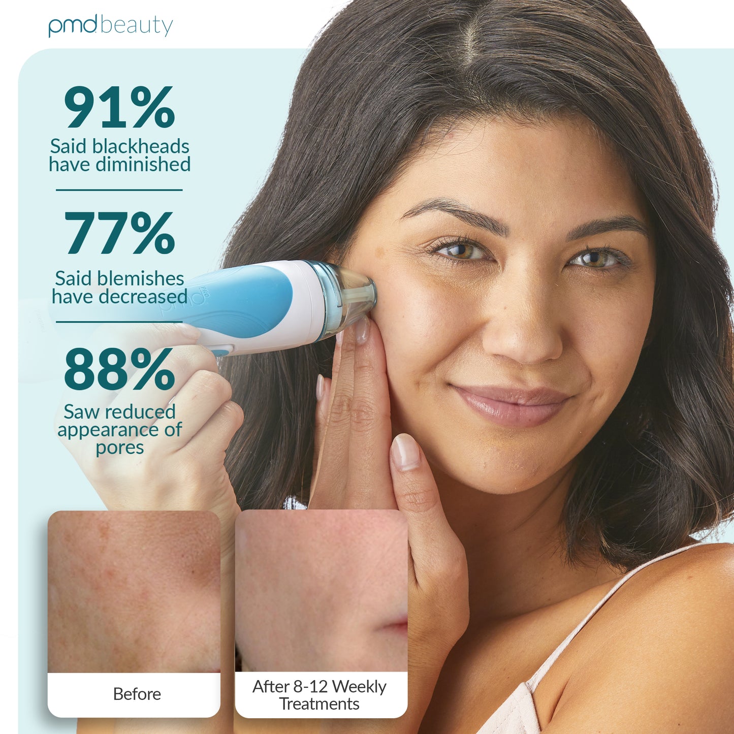 Personal Microderm Pro