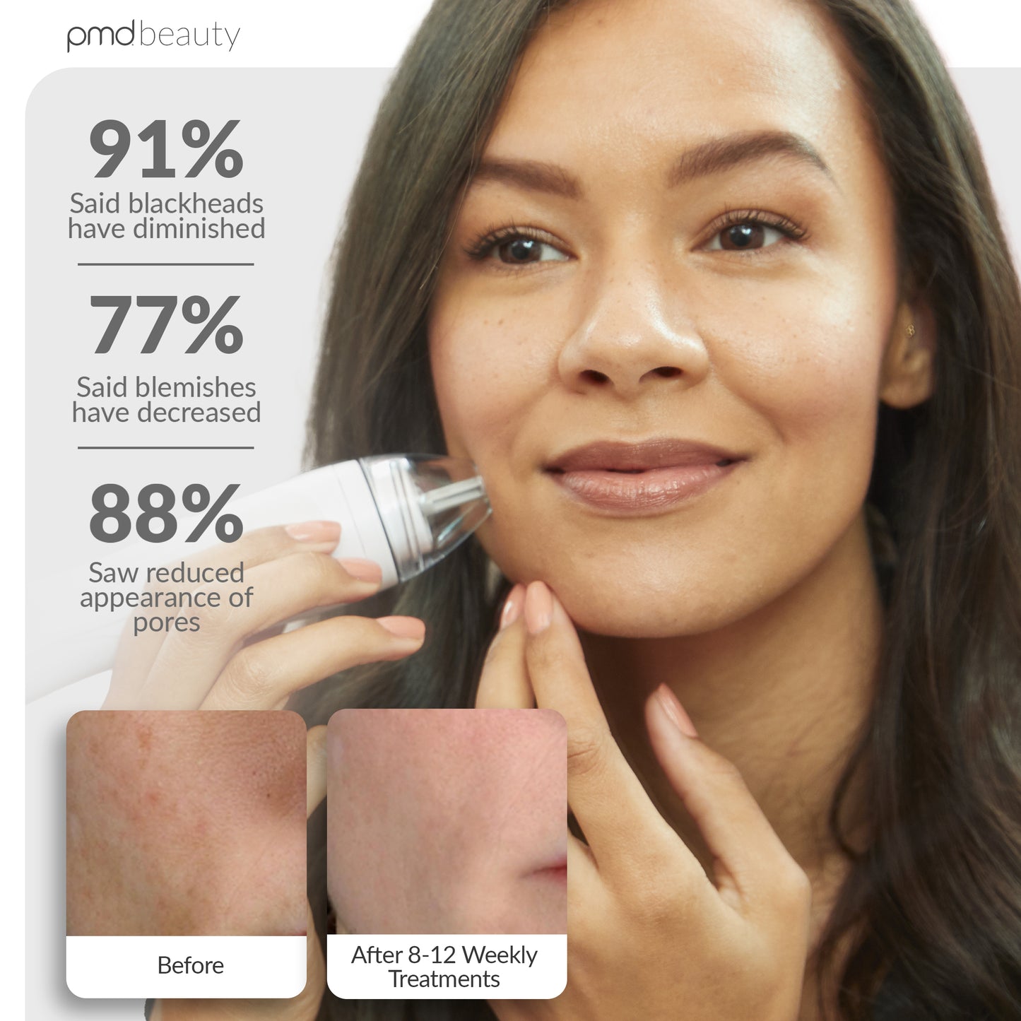 Personal Microderm Pro
