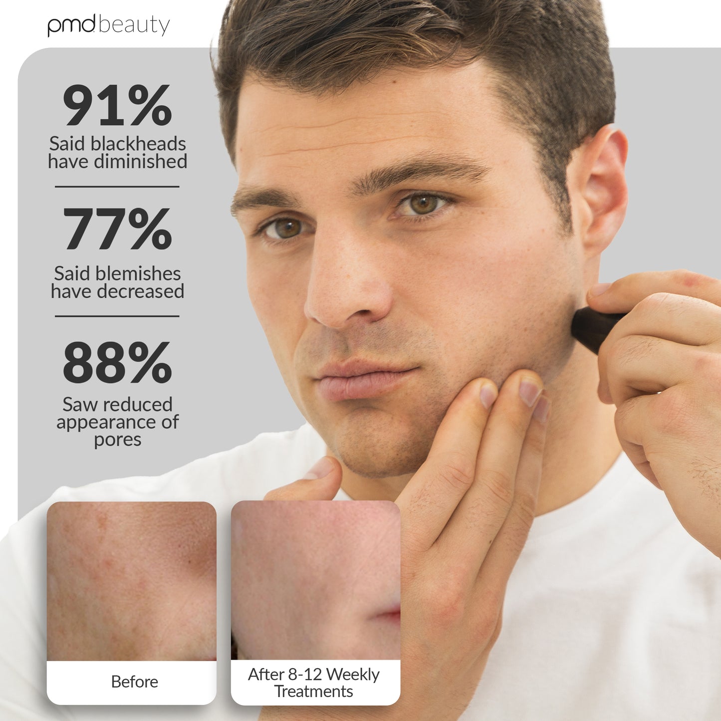 Personal Microderm Man