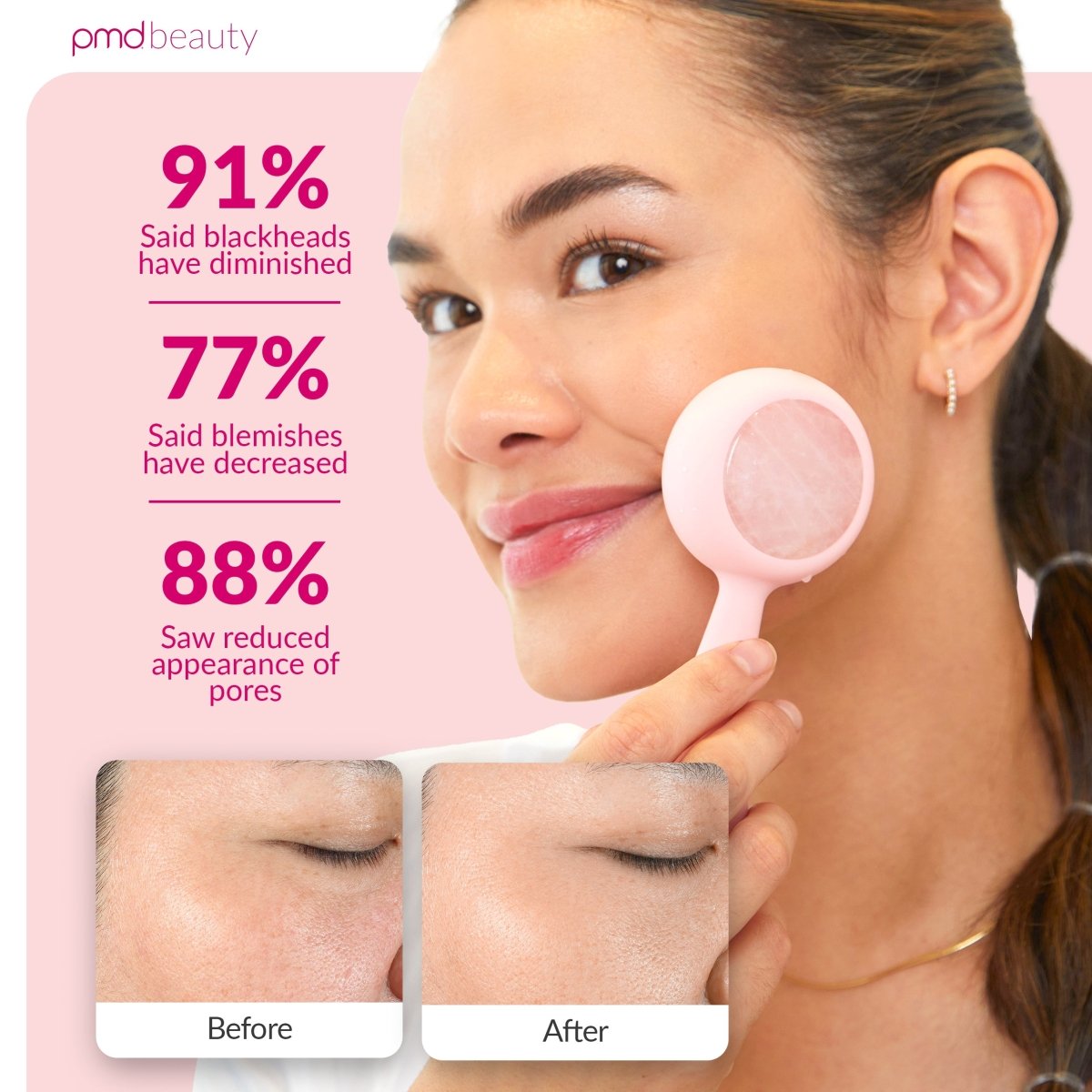 Rose Quartz Cleansing - PMD Clean Pro RQ | PMD Beauty Rose Quartz Cleansing - PMD Clean Pro RQ | PMD Beauty