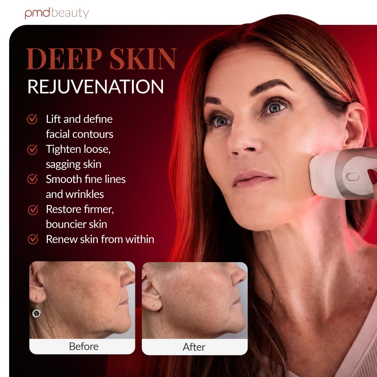 Deep Skin Rejuvenation - PMD HIFU Ultra | PMD Beauty