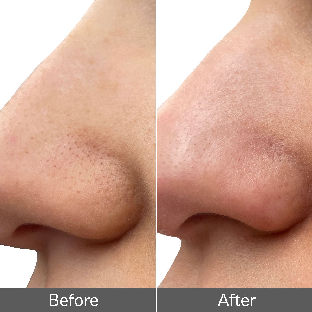 PMD Clean Mini - Compact Facial Cleansing Device | PMD Beauty