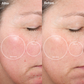 1005-berry?Before and After of The Personal Microderm Elite Pro