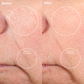 1001-MerBluePro? Before and After With the Personal Microderm Pro 