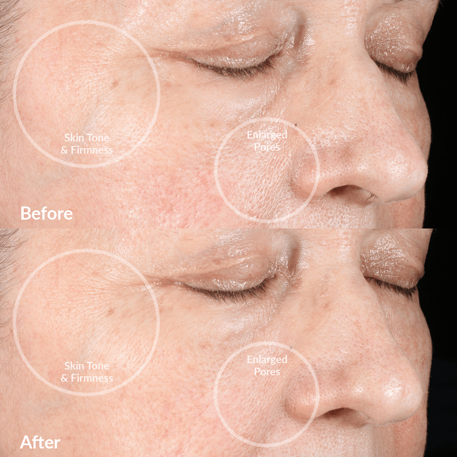 Facial Cleansing Device - PMD Clean Pro | PMD Beauty