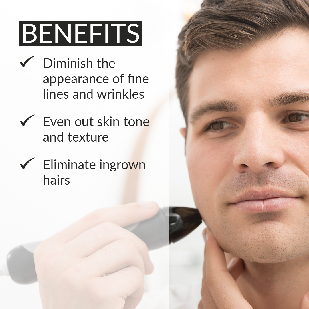 1004?Benefits of the Personal Microderm Man