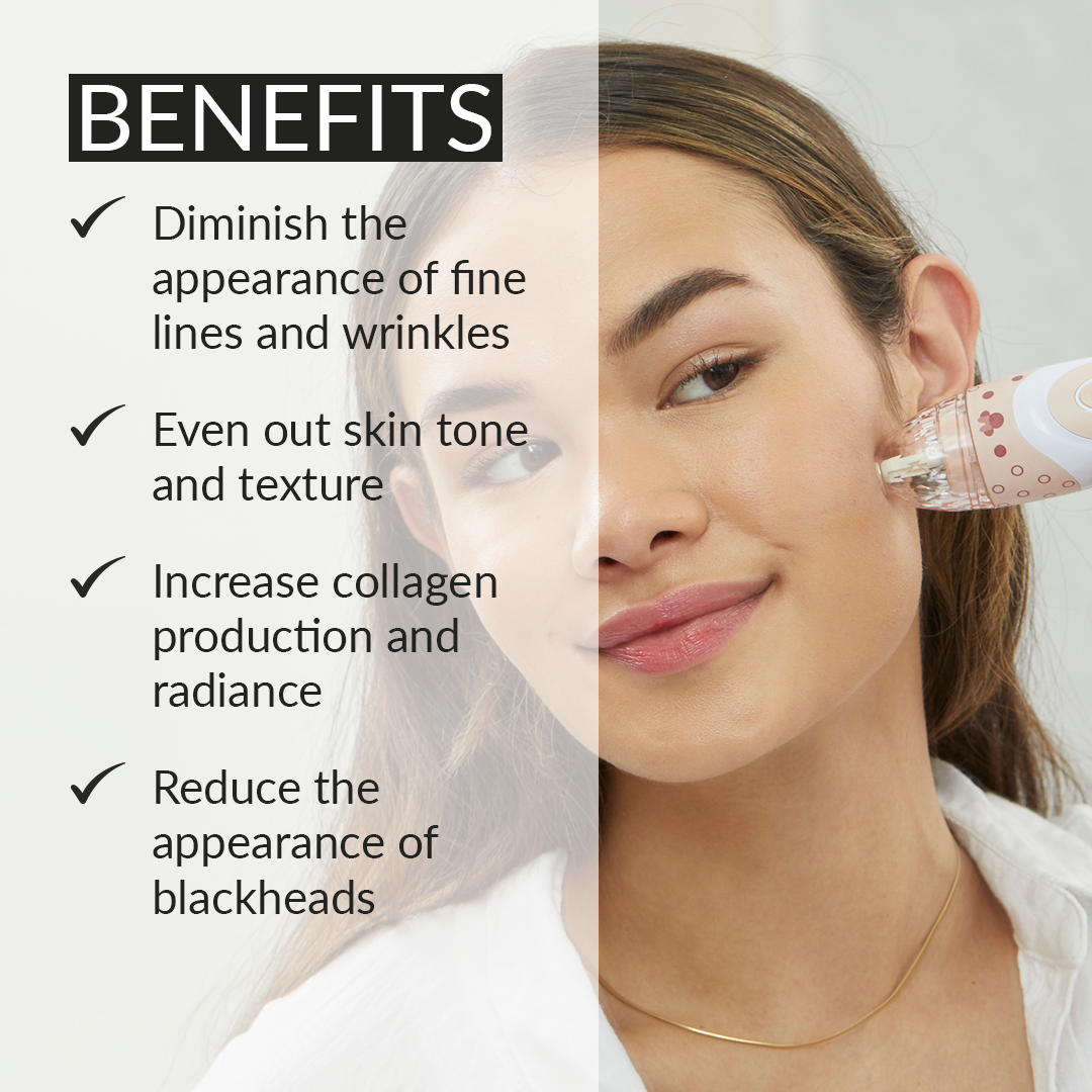 1005-MAUVE-MIN? Benefits of using the Personal Microderm